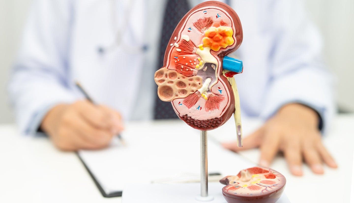 FDA grants priority review to Roche’s Gazyva/Gazyvaro for pMN