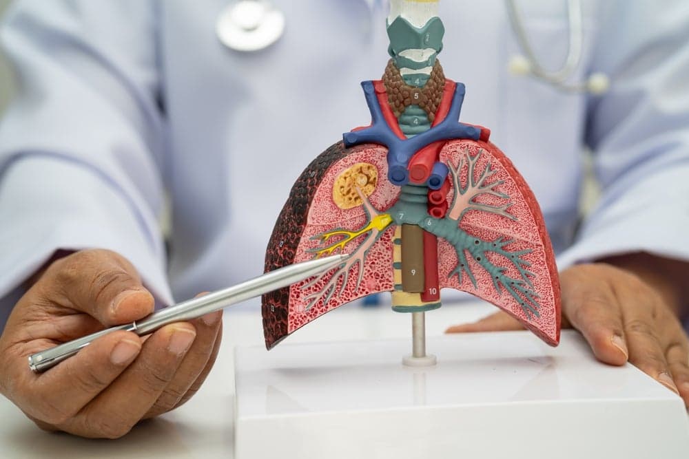 GSK secures first lung cancer approval, validating $10.6bn Nuvalent bet
