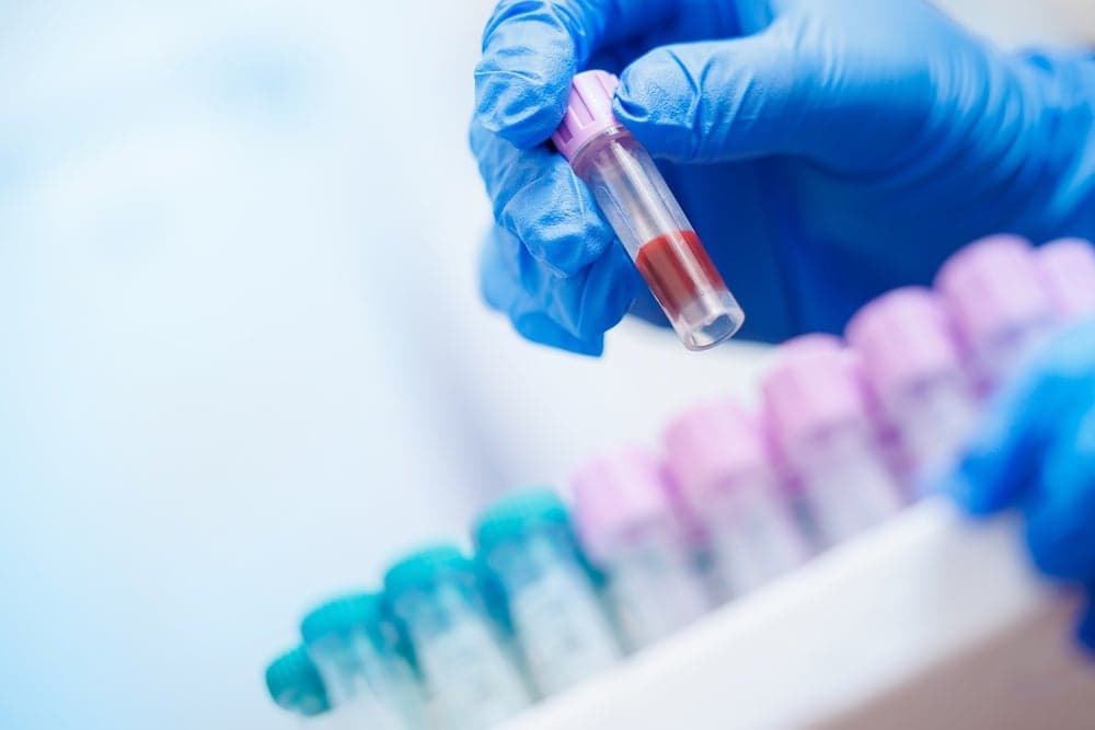 Biomarkers in Nephrology Research: From Exploratory to Decision-Making Tools