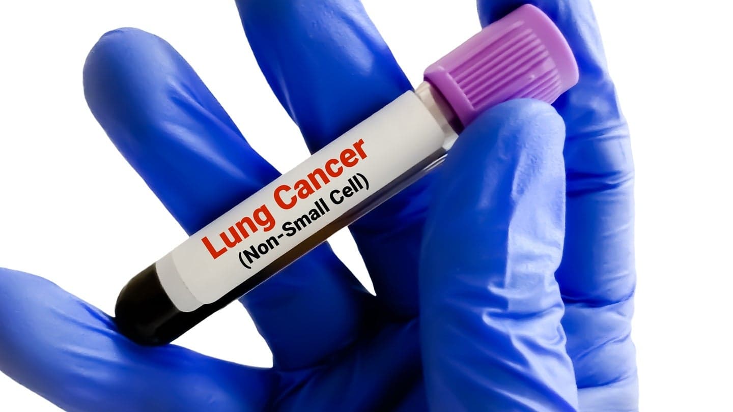 Akeso secures China NMPA authorisation for ivonescimab combo