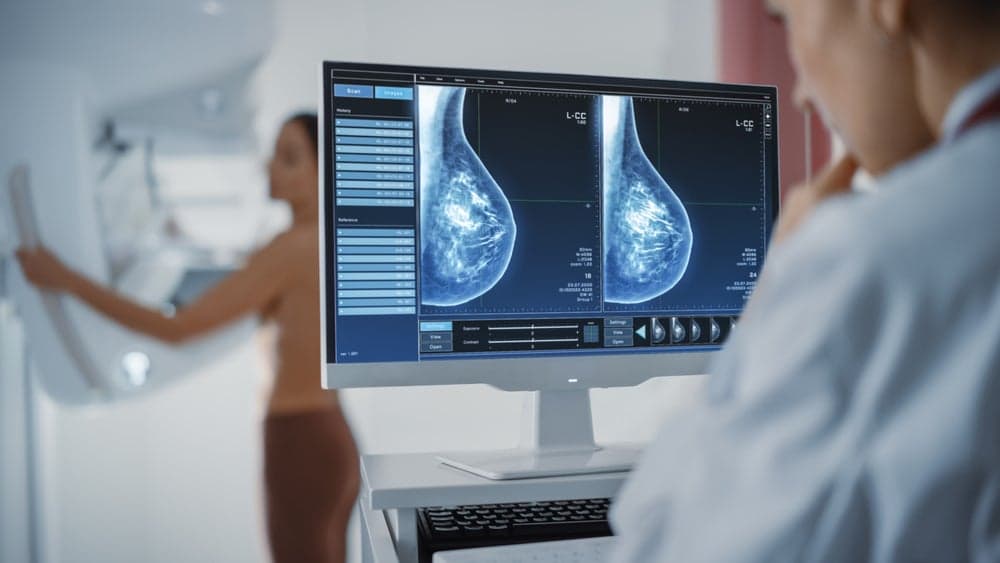 KymaThera pulls in $80m to bring breast cancer drug to clinicÂ