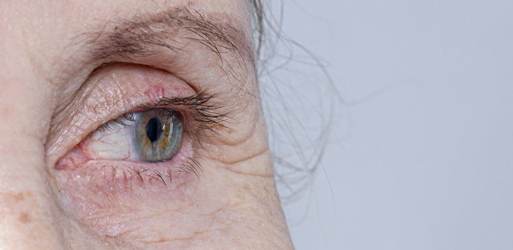 EyePoint halves workforce and ends Phase III trial early after endpoint missÂ